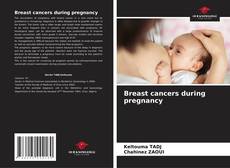Borítókép a  Breast cancers during pregnancy - hoz