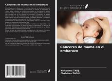 Couverture de Cánceres de mama en el embarazo