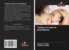 Capa do livro de Tumori al seno in gravidanza 