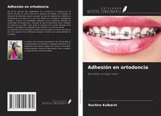 Buchcover von Adhesión en ortodoncia