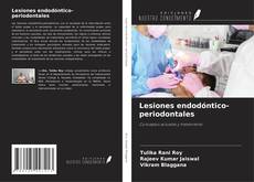 Capa do livro de Lesiones endodóntico-periodontales 