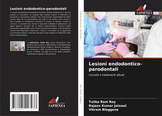 Bookcover of Lesioni endodontico-parodontali