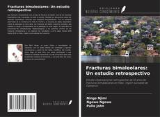 Buchcover von Fracturas bimaleolares: Un estudio retrospectivo
