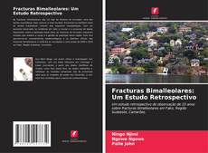 Buchcover von Fracturas Bimalleolares: Um Estudo Retrospectivo