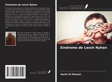 Buchcover von Síndrome de Lesch Nyhan