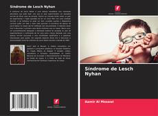 Buchcover von Síndrome de Lesch Nyhan