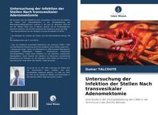 Buchcover von Untersuchung der Infektion der Stellen Nach transvesikaler Adenomektomie