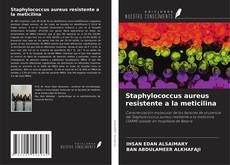 Обложка Staphylococcus aureus resistente a la meticilina