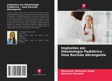 Bookcover of Implantes em Odontologia Pediátrica - Uma Revisão Abrangente