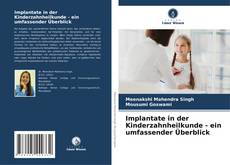 Bookcover of Implantate in der Kinderzahnheilkunde - ein umfassender Überblick