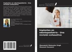 Implantes en odontopediatría - Una revisión exhaustiva kitap kapağı