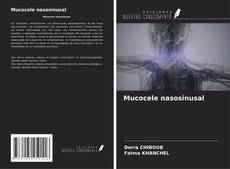 Обложка Mucocele nasosinusal