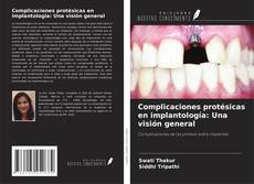 Capa do livro de Complicaciones protésicas en implantología: Una visión general 
