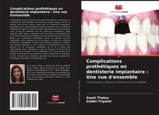 Capa do livro de Complications prothétiques en dentisterie implantaire : Une vue d'ensemble 
