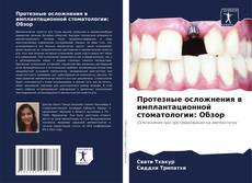 Buchcover von Протезные осложнения в имплантационной стоматологии: Обзор