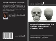 Capa do livro de Tomografía computarizada para imágenes maxilofaciales: El viaje hasta ahora 