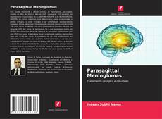 Buchcover von Parasagittal Meningiomas