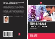 Buchcover von ESTUDO CLÍNICO E PROGNÓSTICO DO CANCRO DO CAVUM