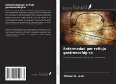 Bookcover of Enfermedad por reflujo gastroesofágico