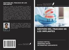 Bookcover of GESTIÓN DEL FRACASO DE LOS IMPLANTES
