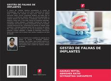 Bookcover of GESTÃO DE FALHAS DE IMPLANTES
