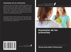 Bookcover of Anomalías de los eritrocitos