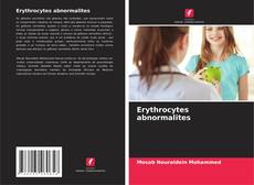 Buchcover von Erythrocytes abnormalites