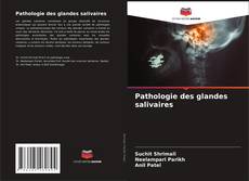 Bookcover of Pathologie des glandes salivaires