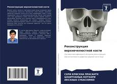 Buchcover von Реконструкция верхнечелюстной кости