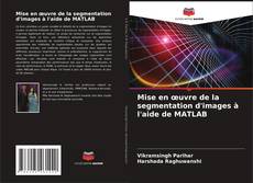 Bookcover of Mise en œuvre de la segmentation d'images à l'aide de MATLAB