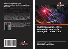Buchcover von Implementazione della segmentazione delle immagini con MATLAB