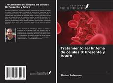 Portada del libro de Tratamiento del linfoma de células B: Presente y futuro