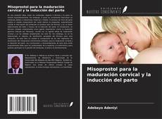 Bookcover of Misoprostol para la maduración cervical y la inducción del parto