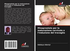 Buchcover von Misoprostolo per la maturazione cervicale e l'induzione del travaglio