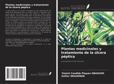 Buchcover von Plantas medicinales y tratamiento de la úlcera péptica