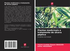 Bookcover of Plantas medicinais e tratamento de úlcera péptica