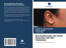 Buchcover von Brachytherapie mit hoher Dosisrate bei Ohr-Cheloiden