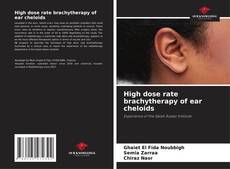 Copertina di High dose rate brachytherapy of ear cheloids