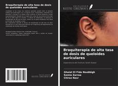 Capa do livro de Braquiterapia de alta tasa de dosis de queloides auriculares 