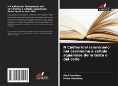 Capa do livro de N Cadherina/ ialuronano nel carcinoma a cellule squamose della testa e del collo 