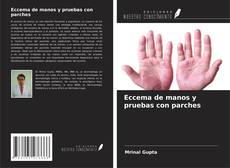 Eccema de manos y pruebas con parches kitap kapağı