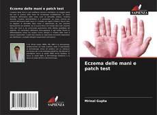 Buchcover von Eczema delle mani e patch test