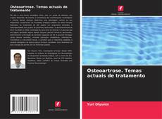 Bookcover of Osteoartrose. Temas actuais de tratamento