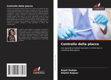 Bookcover of Controllo della placca