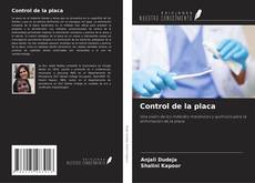 Bookcover of Control de la placa