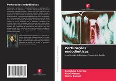 Buchcover von Perfurações endodônticas