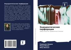 Buchcover von Эндодонтические перфорации