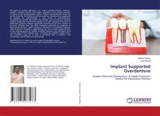 Copertina di Implant Supported Overdenture