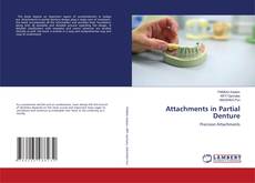 Copertina di Attachments in Partial Denture