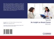 Copertina di An Insight on Breast Cancer